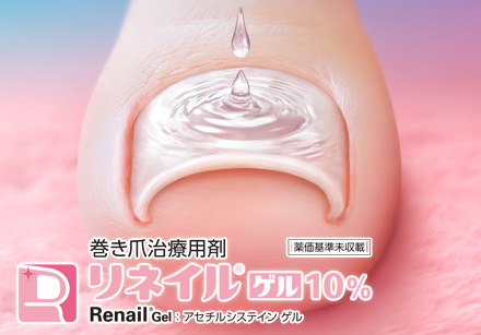 リネイルゲルについて
